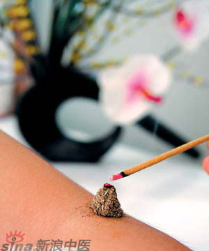 節(jié)氣灸” 冬至，你灸了嗎？
