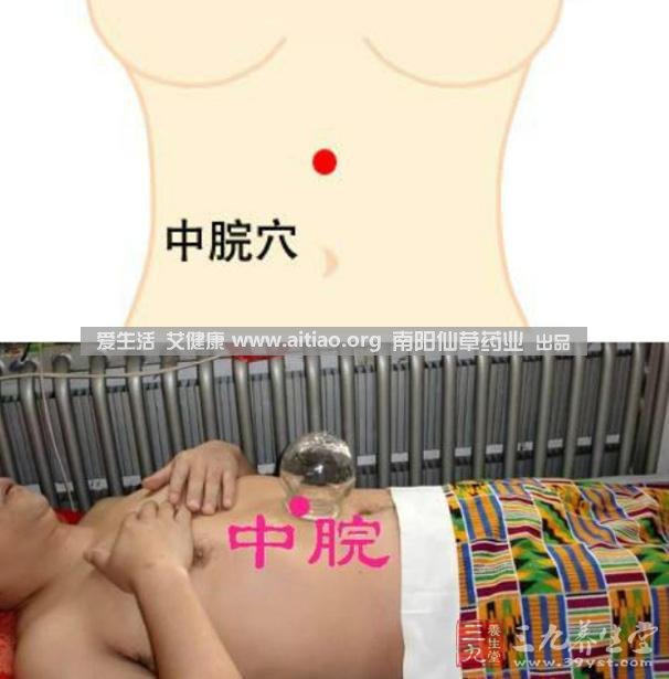 中脘穴位于腹部正中線，臍上4寸的位置上。每天艾灸10-15分鐘，能有效緩解胃部不適的癥狀，同時有助于祛濕。