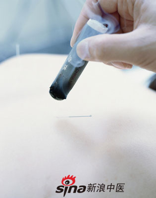 點擊將在新窗口查看全圖 反復咳嗽 試試中醫特色療法